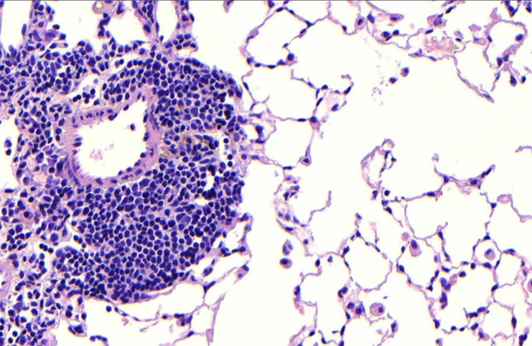 Lung follicle