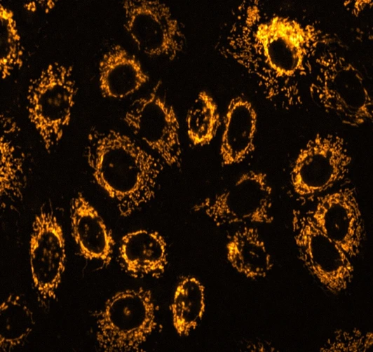 Bild Schmid group Radiobiology IRM