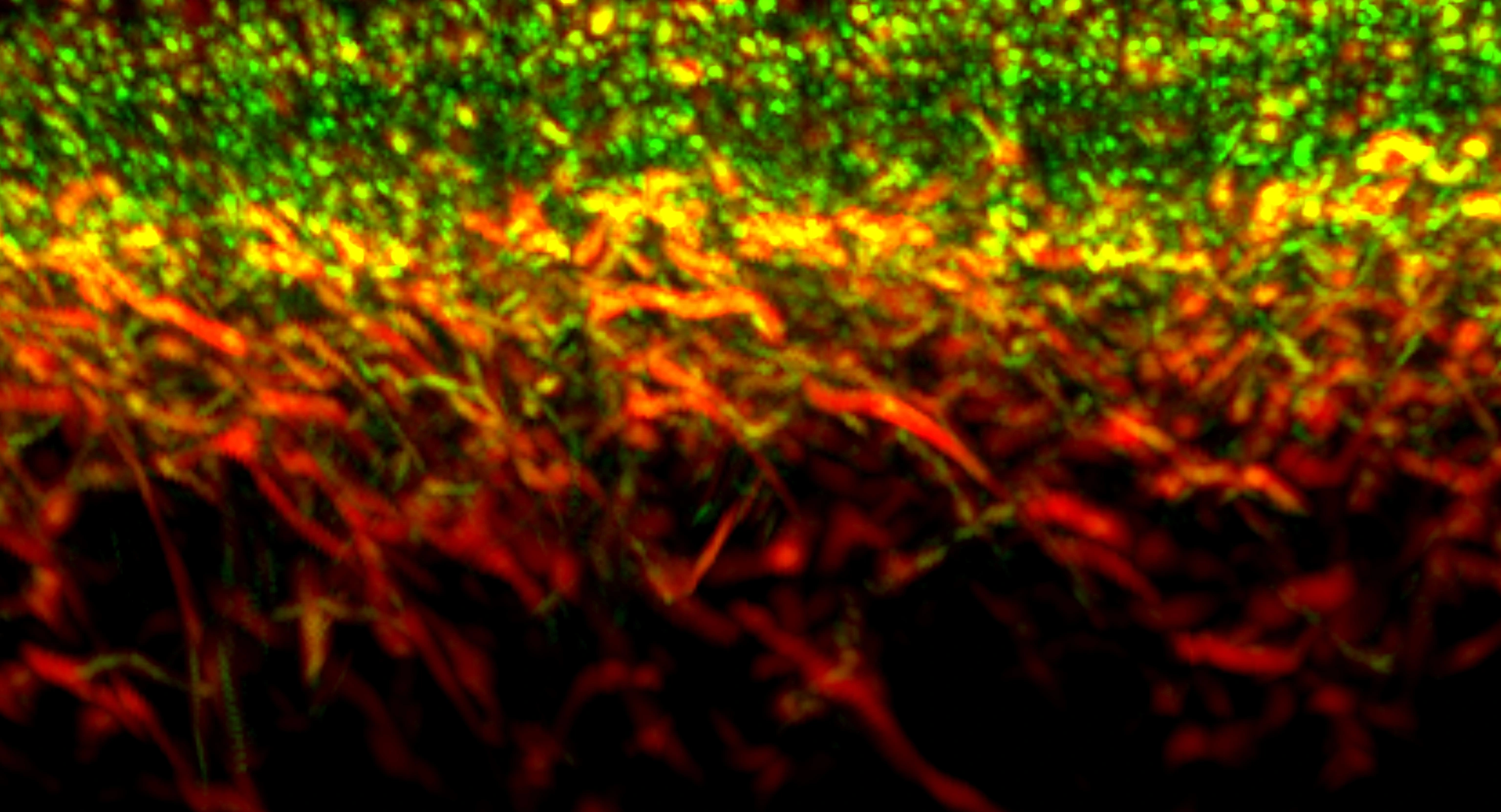 IBMI_Slider_03_RSOM_skin