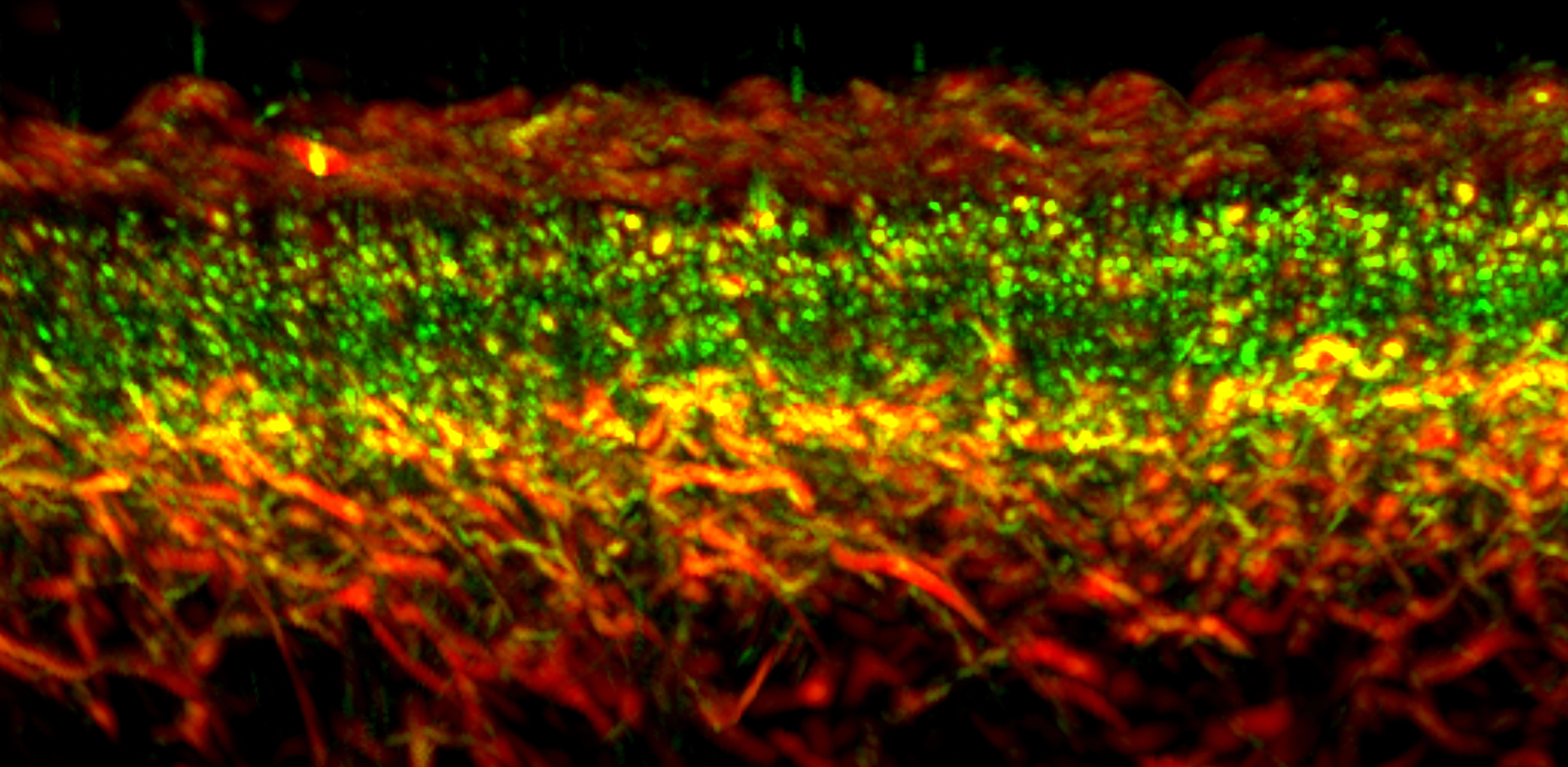 IBMI_Slider_03_RSOM_skin