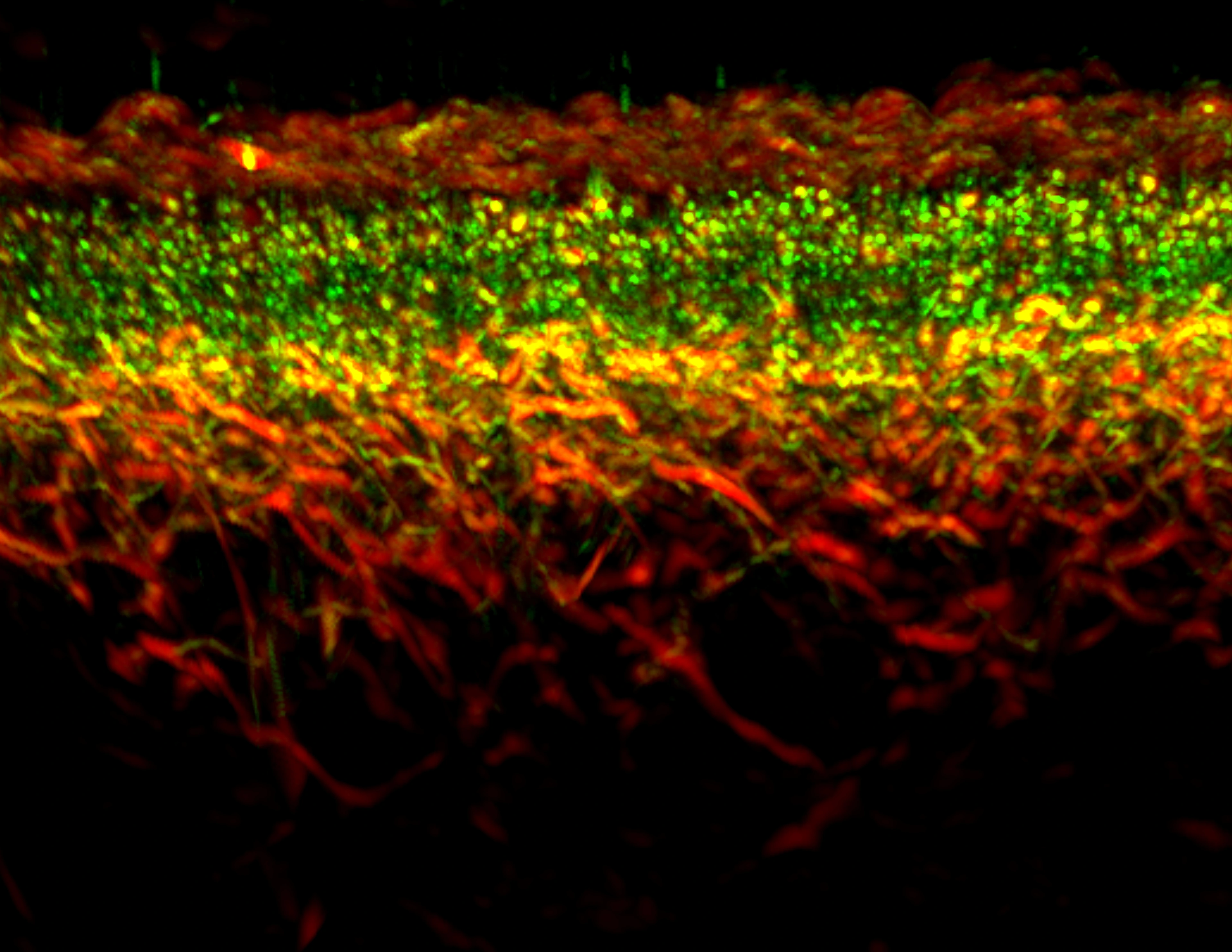 IBMI_Slider_03_RSOM_skin