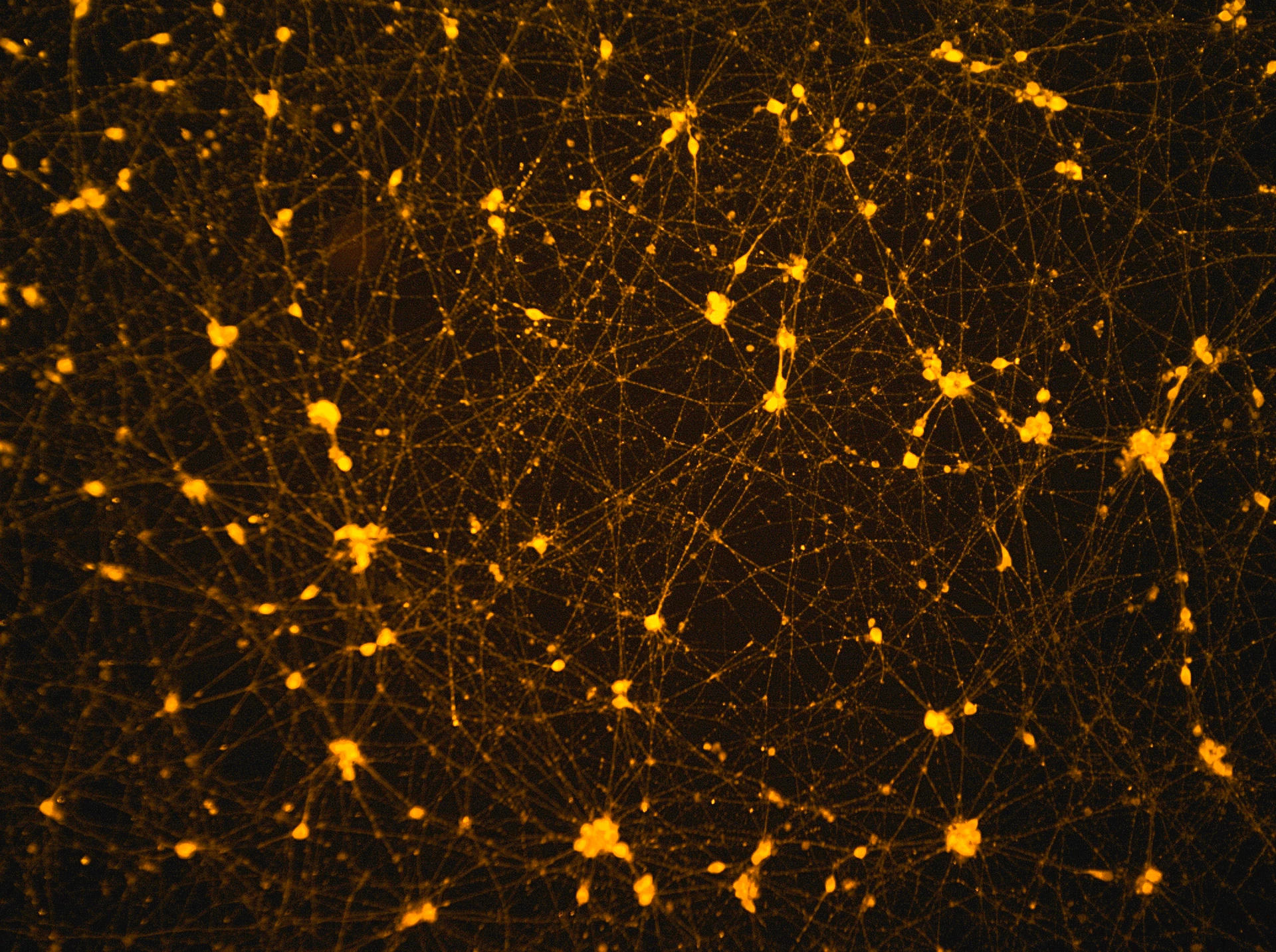 Hypothalamic-like neurons developed from patient-specific induced pluripotent stem cells