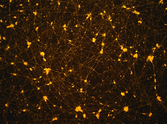 Hypothalamic-like neurons developed from patient-specific induced pluripotent stem cells