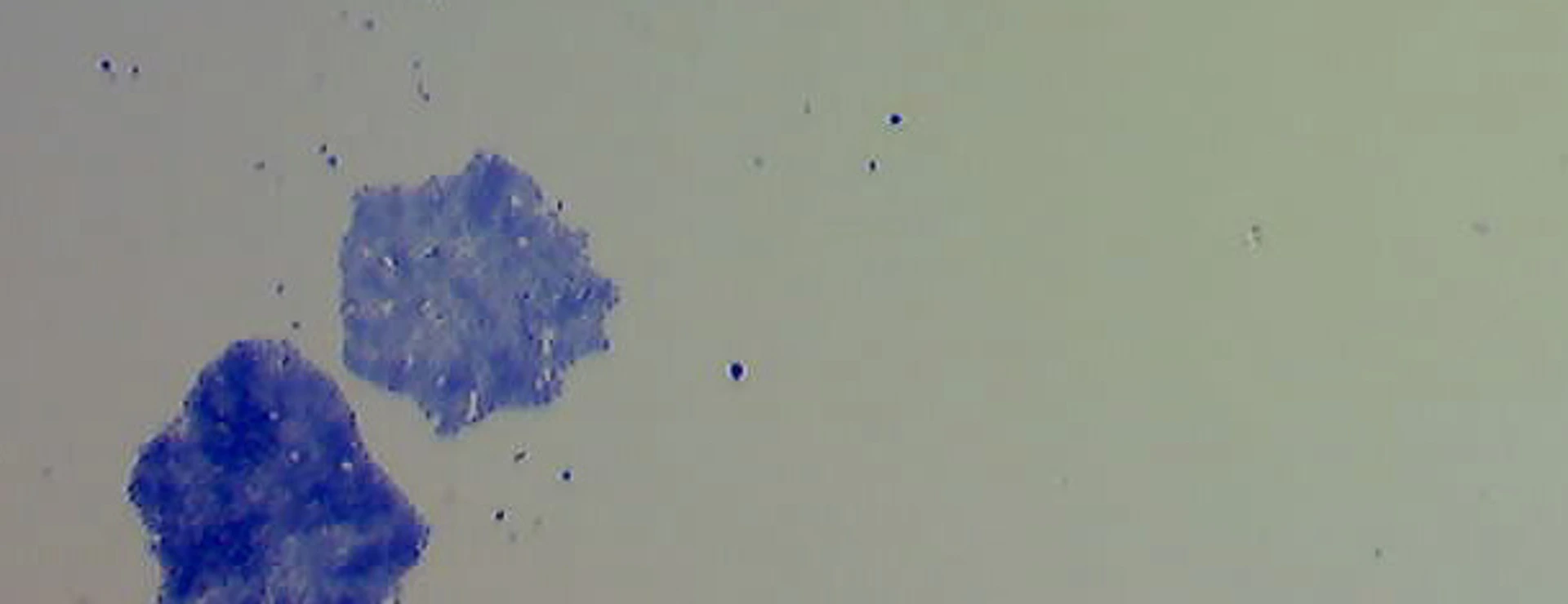 ZYTO_news_ClonogenicGrowth