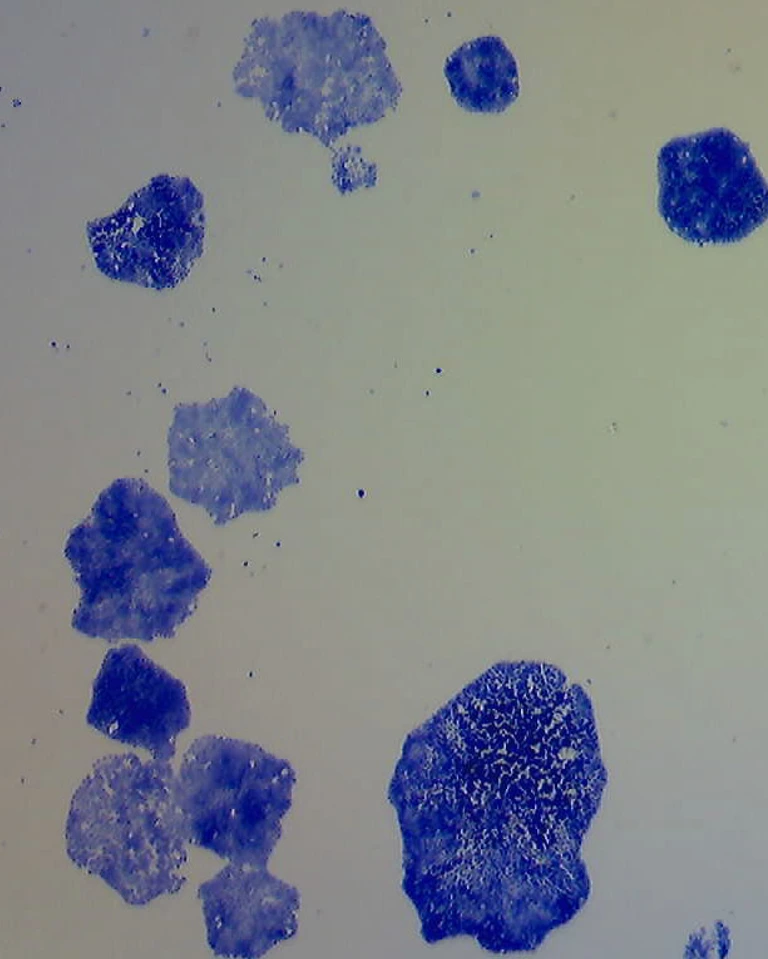 ZYTO_news_ClonogenicGrowth