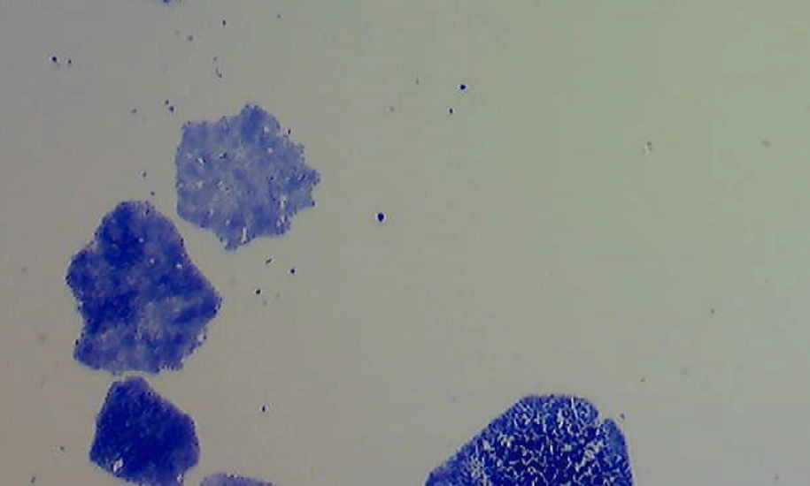 ZYTO_news_ClonogenicGrowth