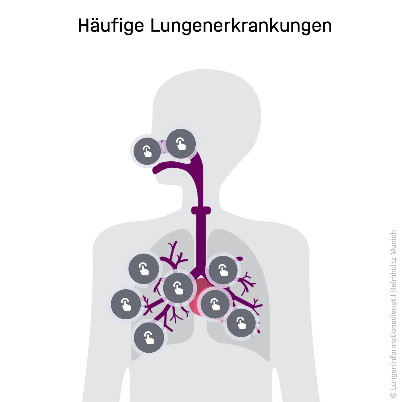 Vorschaubild interaktive Grafik Lungenerkrankungen