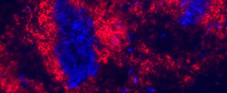 Button_Molecular_Immunoregulation
