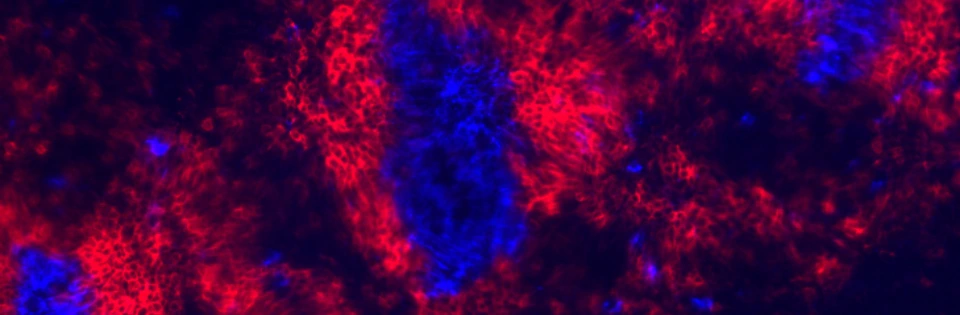 Button_Molecular_Immunoregulation