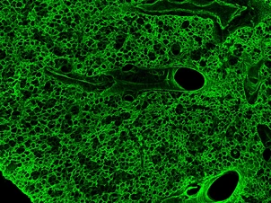 LHI bioArchive_Lung Tissue_630x473px