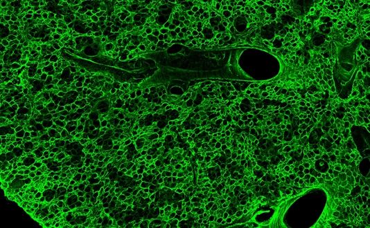 LHI bioArchive_Lung Tissue_630x473px