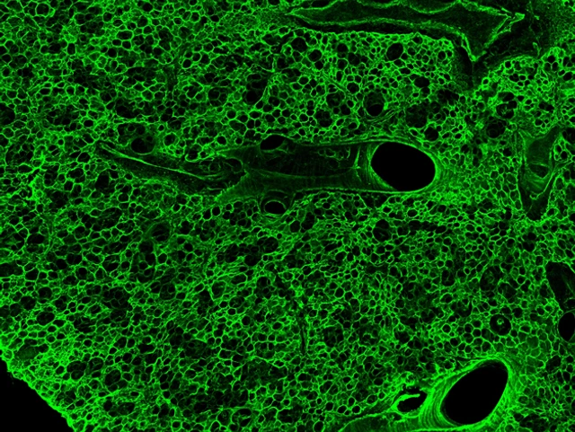 LHI bioArchive_Lung Tissue_630x473px