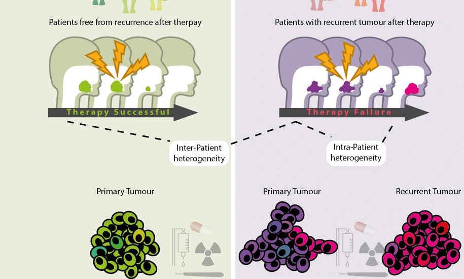 sketch news tumor relapse