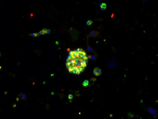 LHI_lehmann_control organoids_630x473px