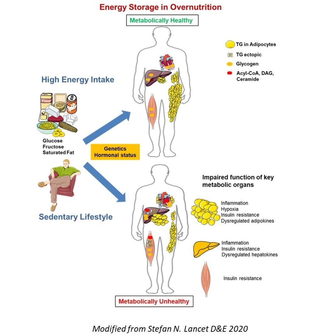 Energy_Storage_in_Overnutrition