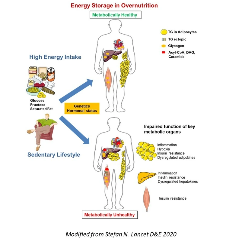 Energy_Storage_in_Overnutrition