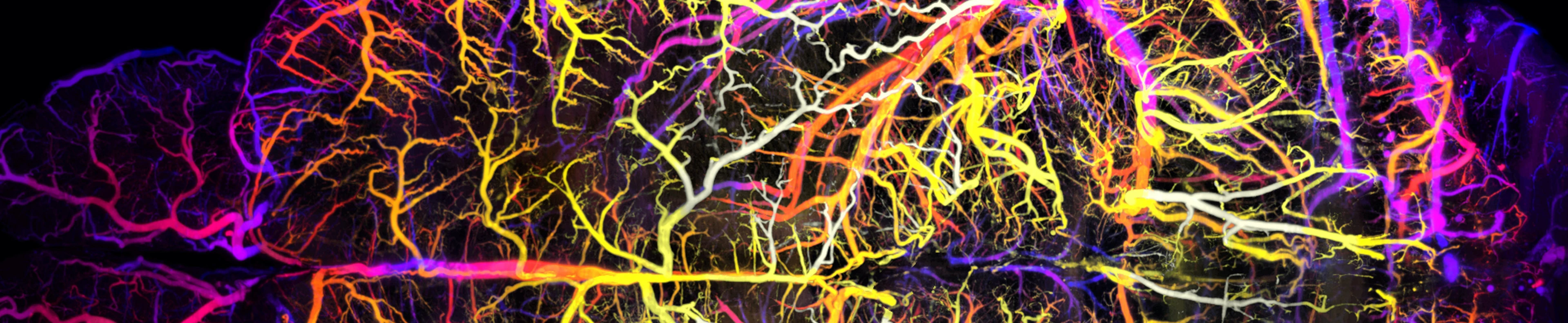 iTERM_banner_mouse brain vessels