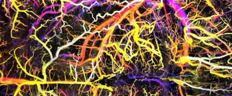iTERM_banner_mouse brain vessels