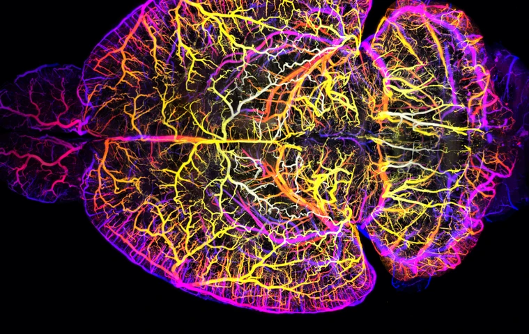 iTERM_banner_mouse brain vessels