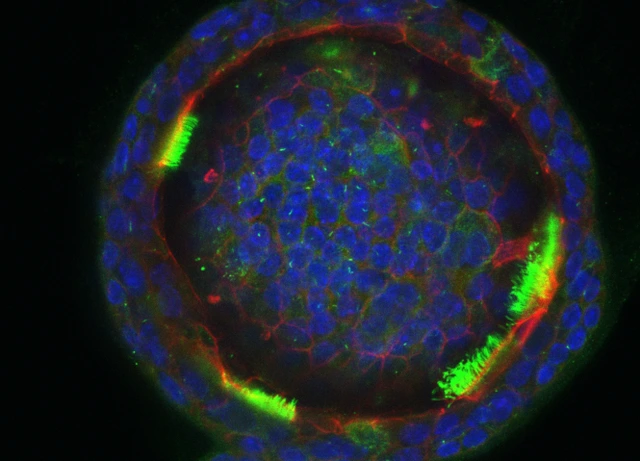 Lung_Organoid_2_Funk_Lab_LHI