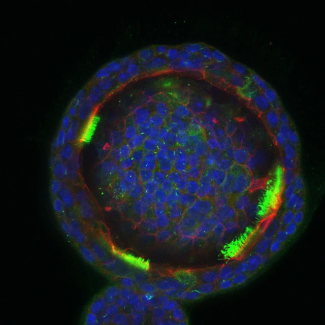 Lung_Organoid_2_Funk_Lab_LHI