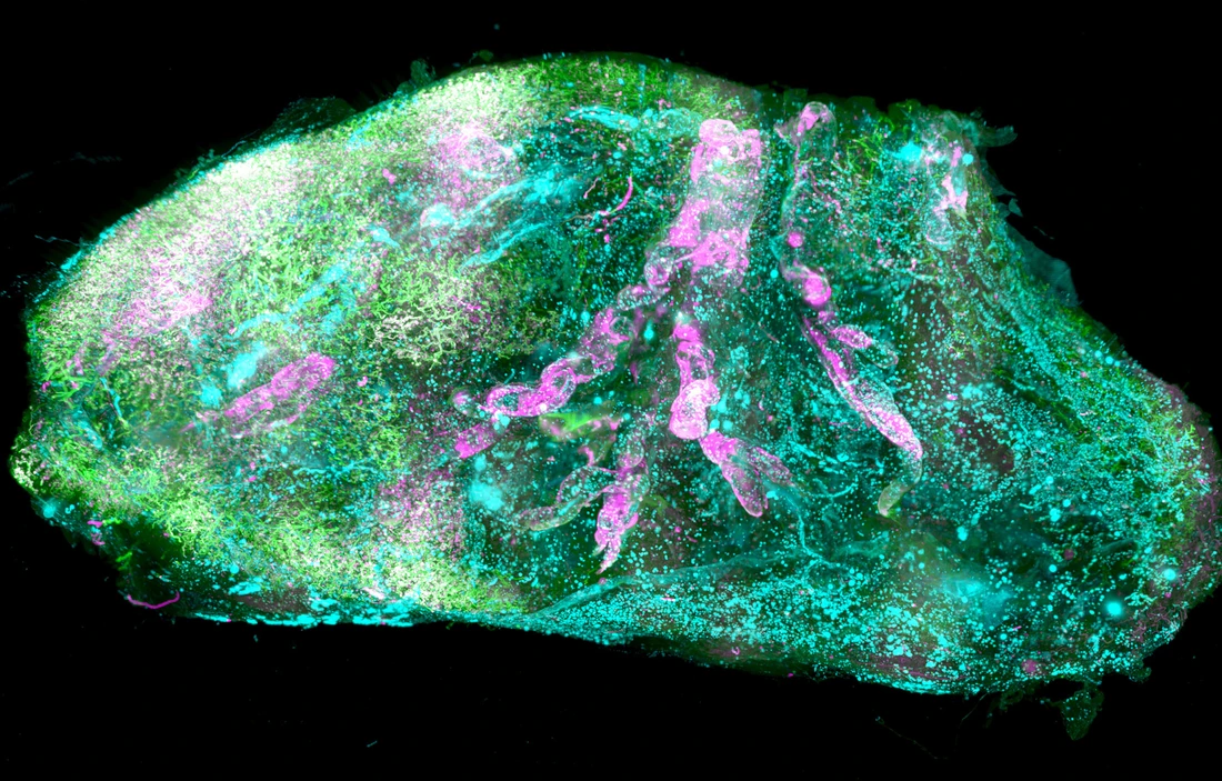 Transparent human kidney