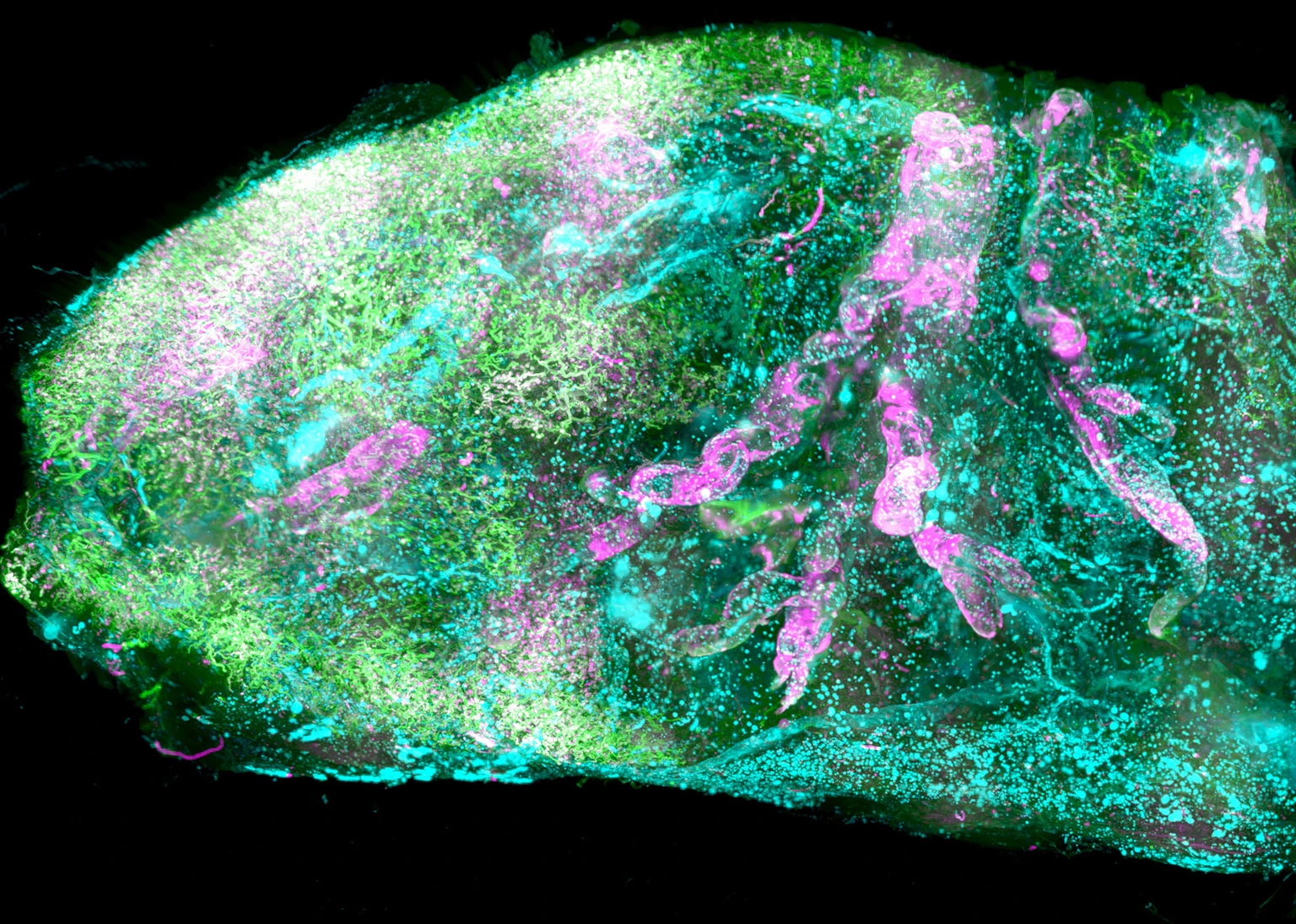 Transparent human kidney