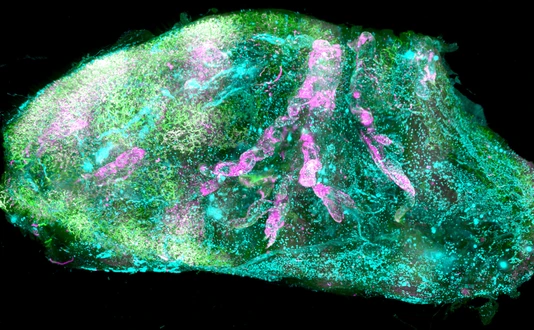 Transparent human kidney