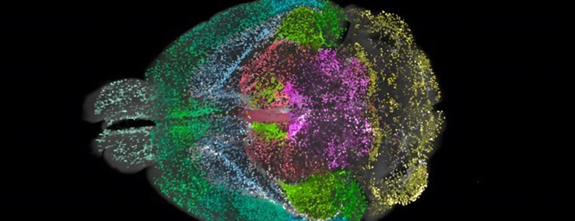DELiVR mouse brain