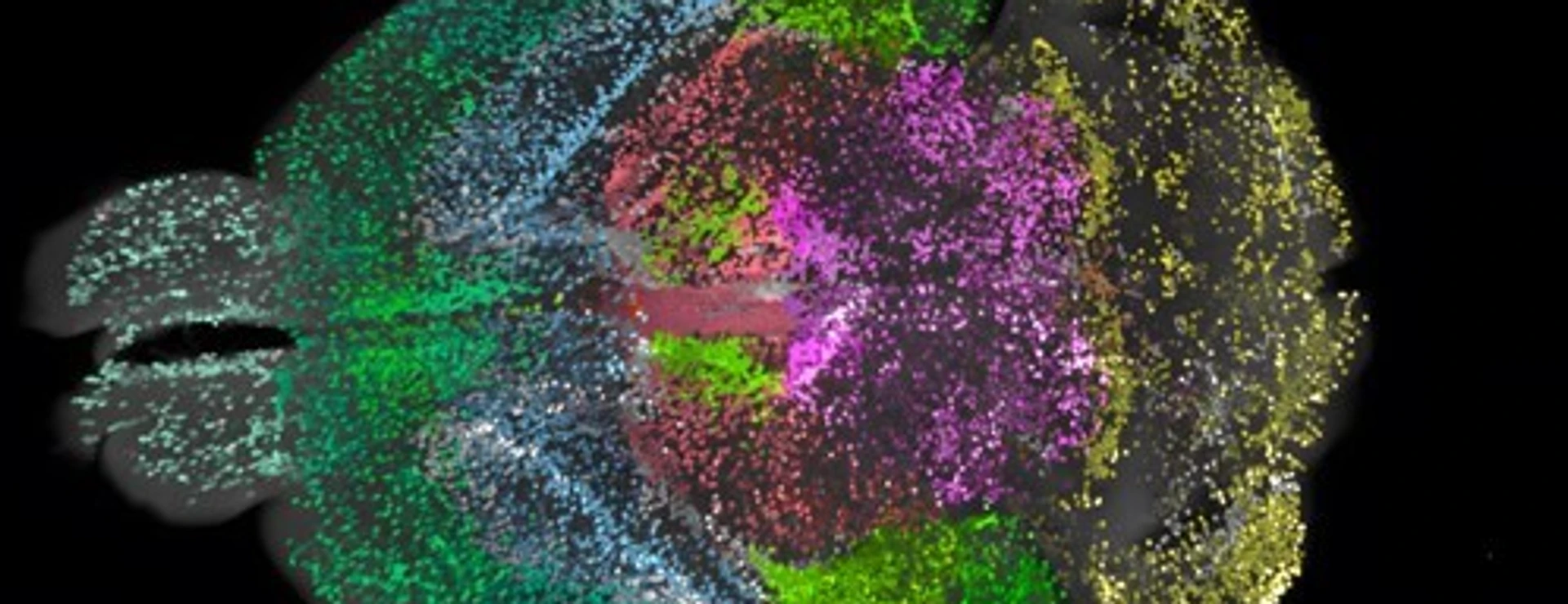 DELiVR mouse brain