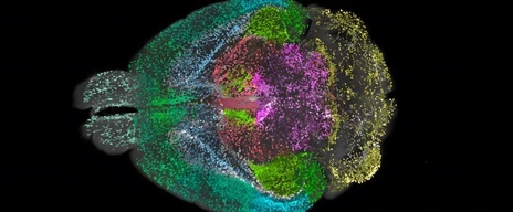 DELiVR mouse brain