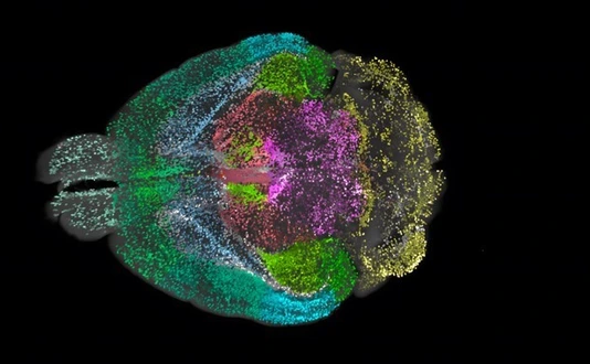 DELiVR mouse brain