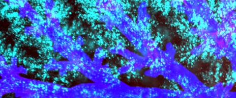 AI-assisted aerosol distribution in lung LHI