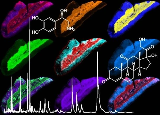 MALDI imaging of adrenal glands.