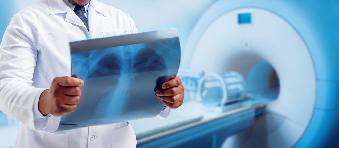 Doctor looking MRI picture.