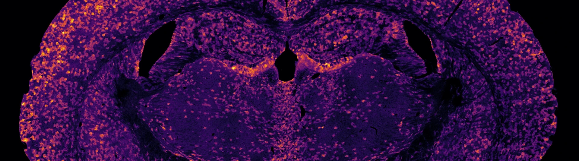 Confocal microscopy image of a mouse brain
