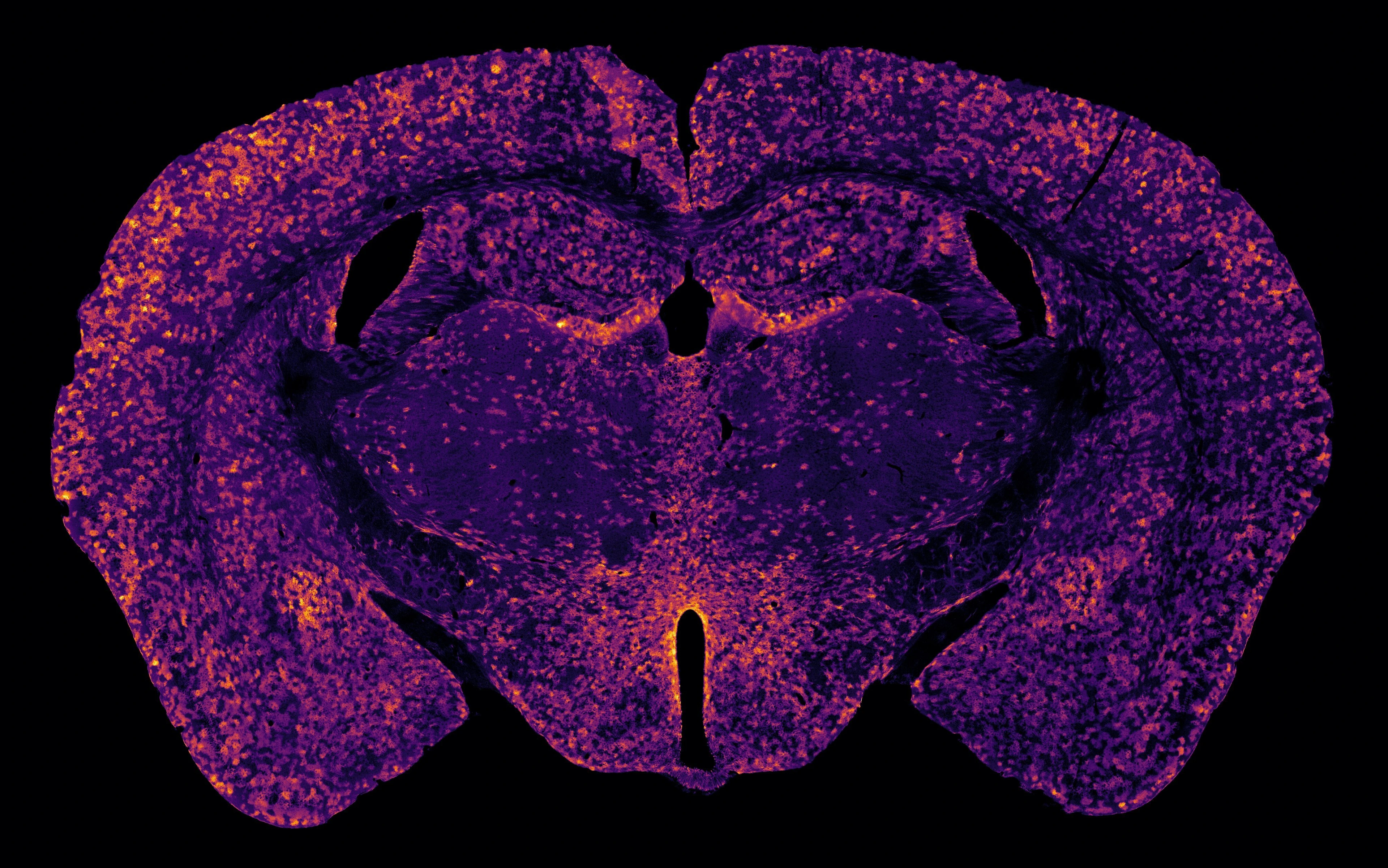 Confocal microscopy image of a mouse brain