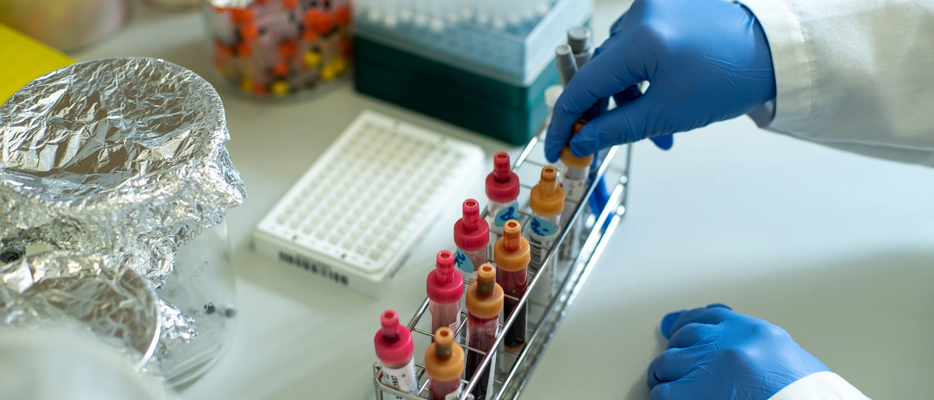 Arbeit an Blutproben in der Asklepios Biobank
