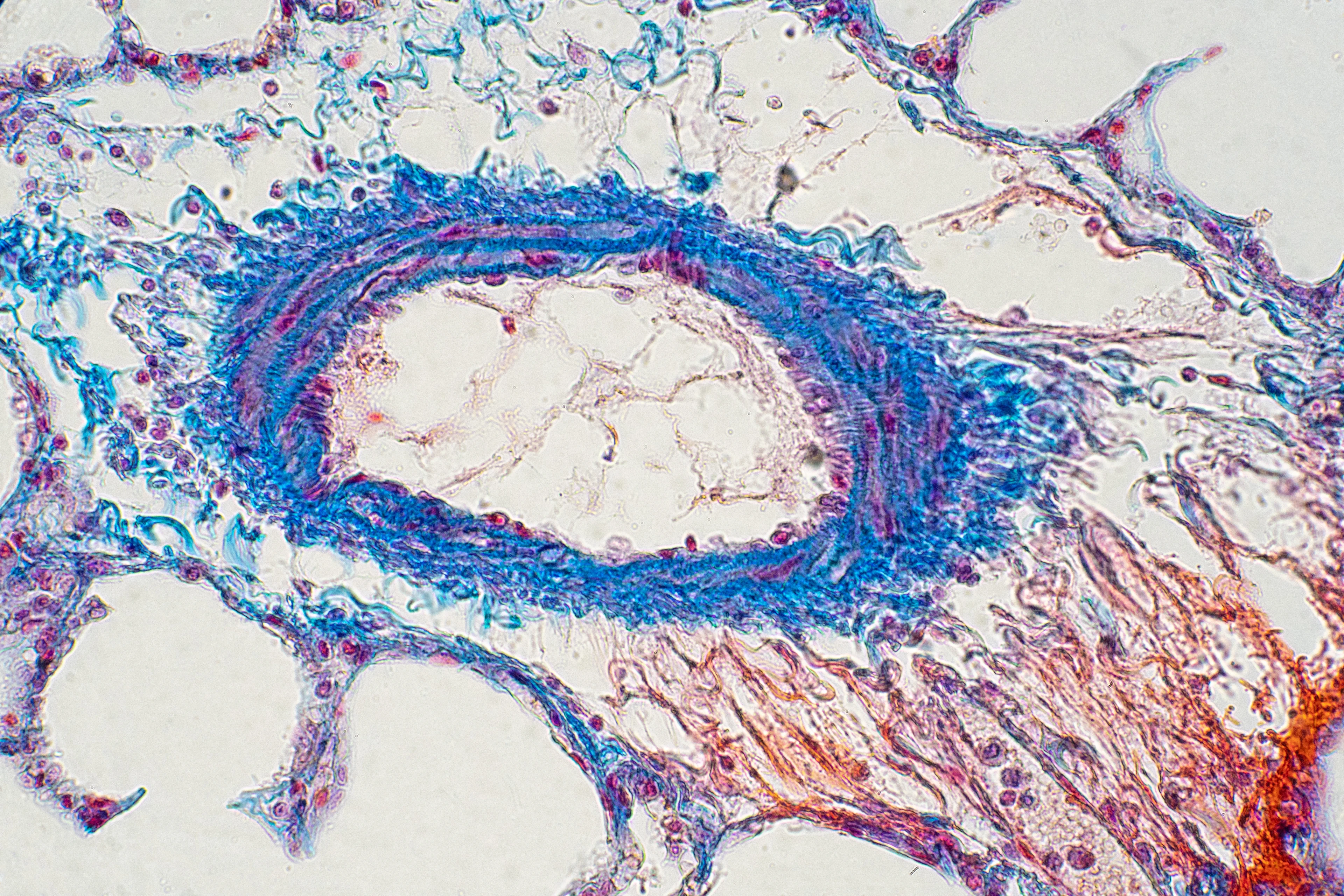Human lung tissue under microscope view.