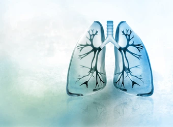 Exogene allergische Alveolitis
