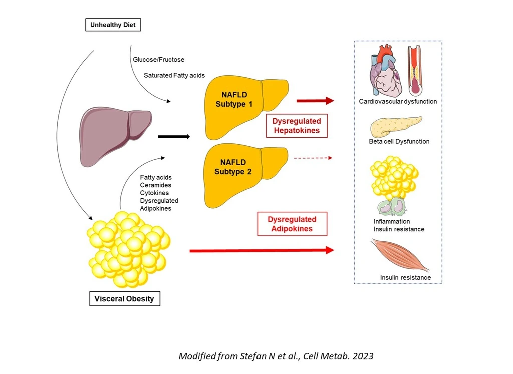 Causes_Cardiometabolic_Consequences_NAFLD