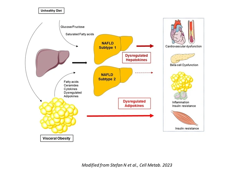 Causes_Cardiometabolic_Consequences_NAFLD