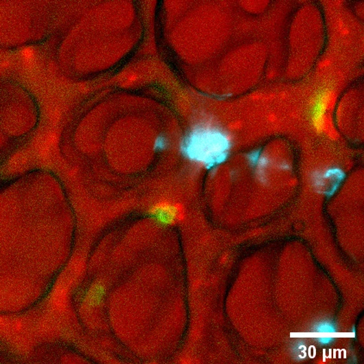 alveoli_lung_tissue_rehberg_Lab_LHI