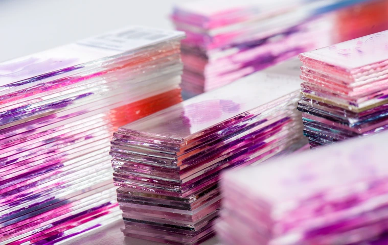 Slides with stained tissue sections