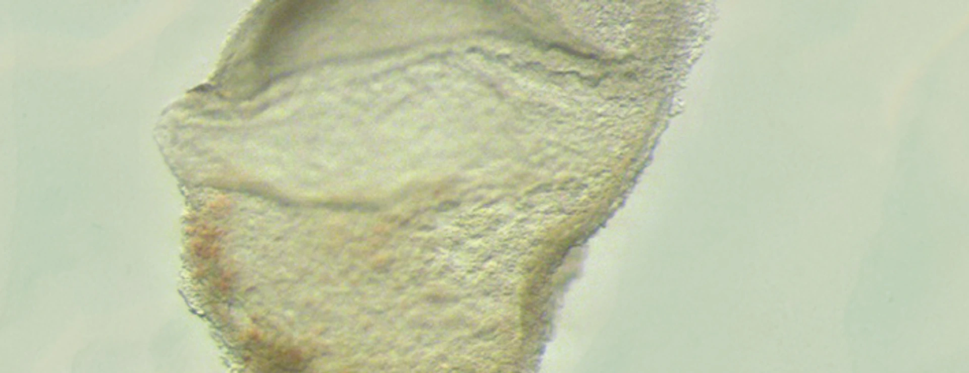 Human Embryo at gastrula stage