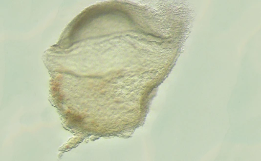 Human Embryo at gastrula stage