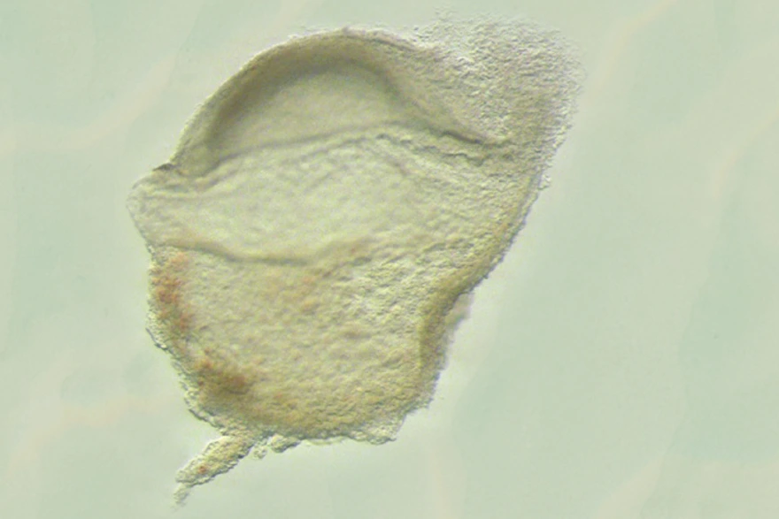 Human Embryo at gastrula stage