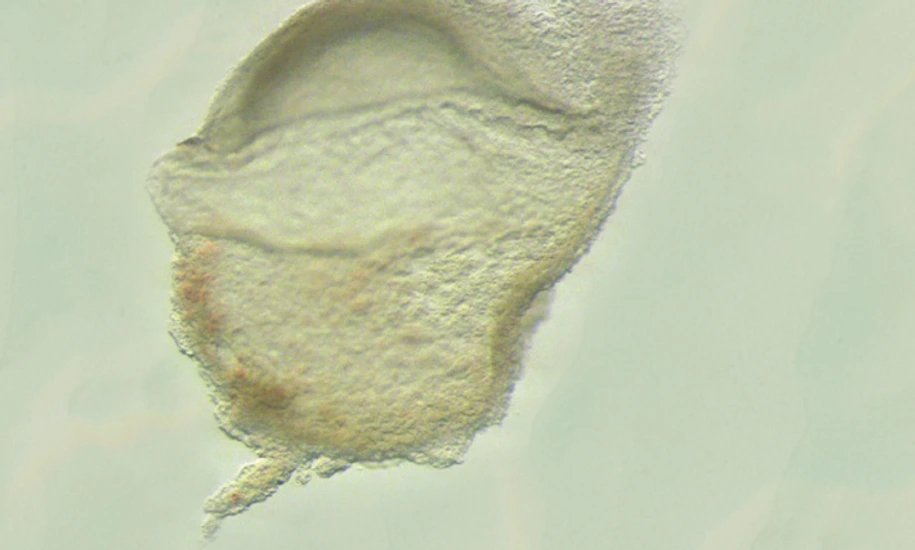 Human Embryo at gastrula stage