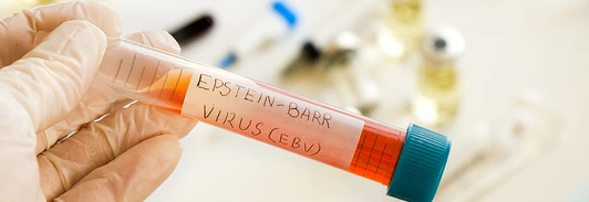 Mononucleosis and Epstein-barr virus blood test sample in lab on the white background