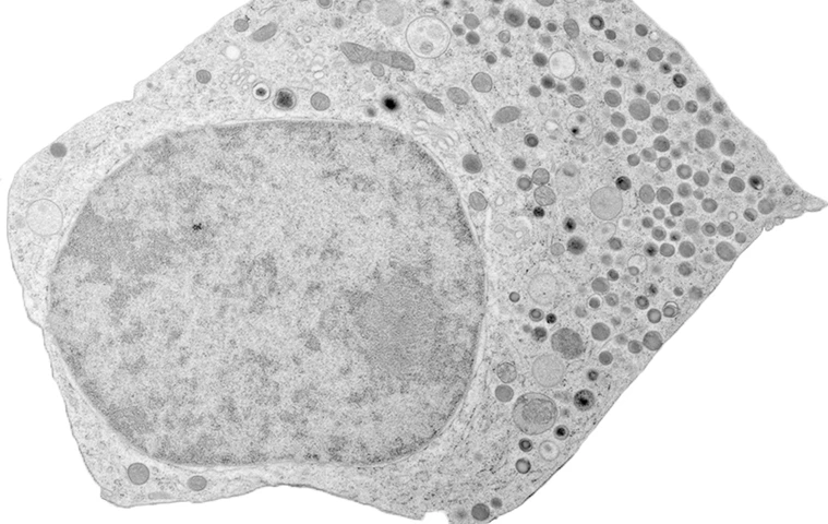BetaCell_EM-Bild_transparent